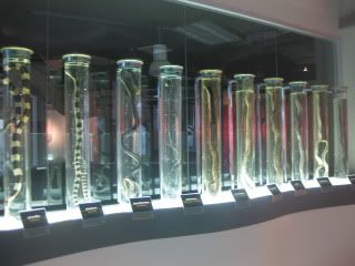 Most of the preserved snakes were too distorted to be of real interest.